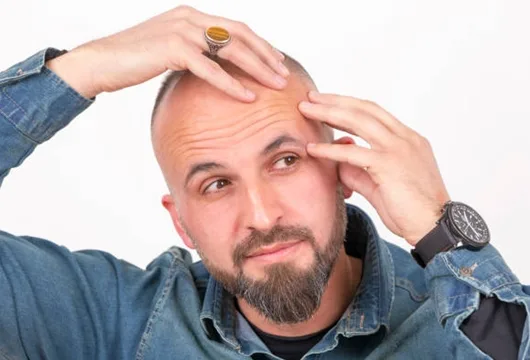 porter une casquette peut fait perdre les cheveux